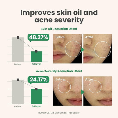 AXIS-Y Spot the Difference
Blemish Treatment - 15ml