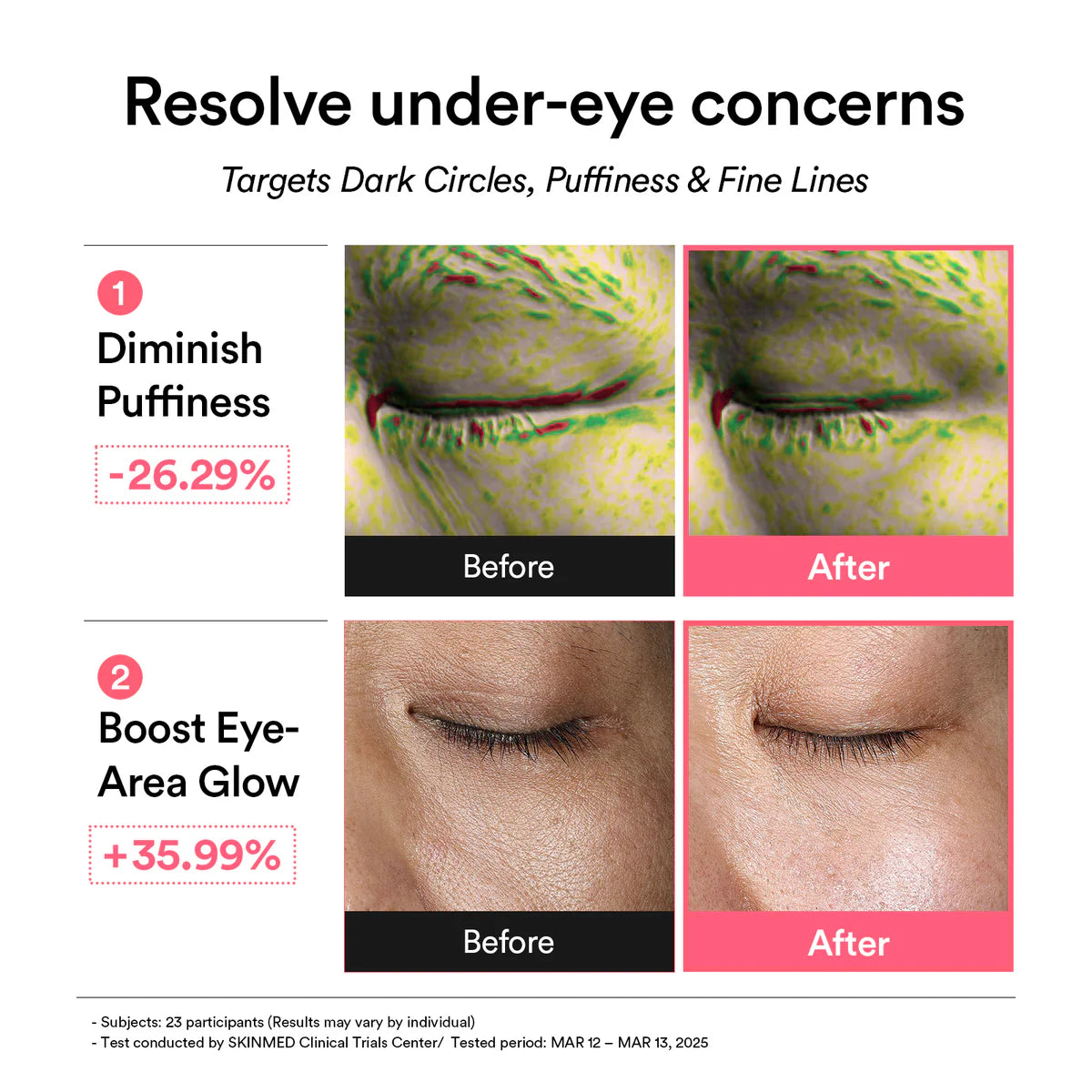 ABIB PDRN Retinal Eye
Patch Glow Jelly - 60EA